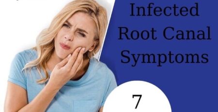 symptoms and signs of infected root canal