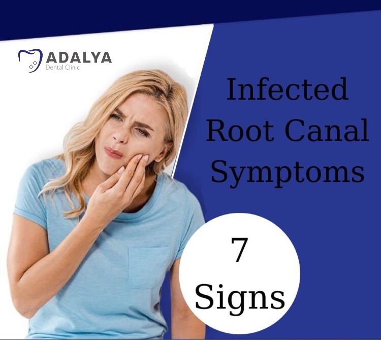 symptoms and signs of infected root canal