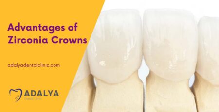 advantages of zirconia crowns