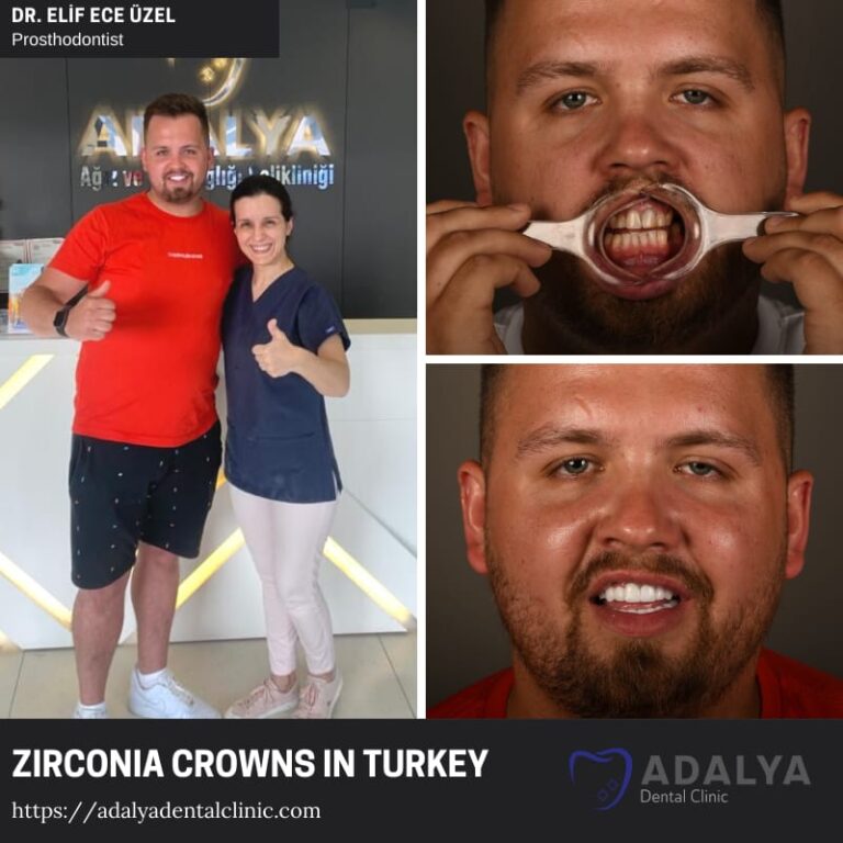 Dentistry Turkey Cosmetic Dentistry Antalya Adalya Dental Clinic