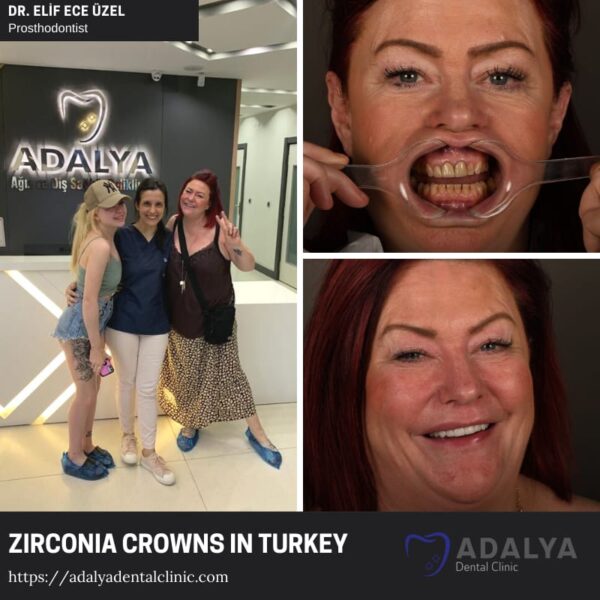 Dental Clinic Turkey Antalya First Class Dental Centre in Antalya