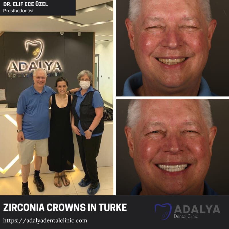 turkey teeth prices zirconia crown antalya istanbul
