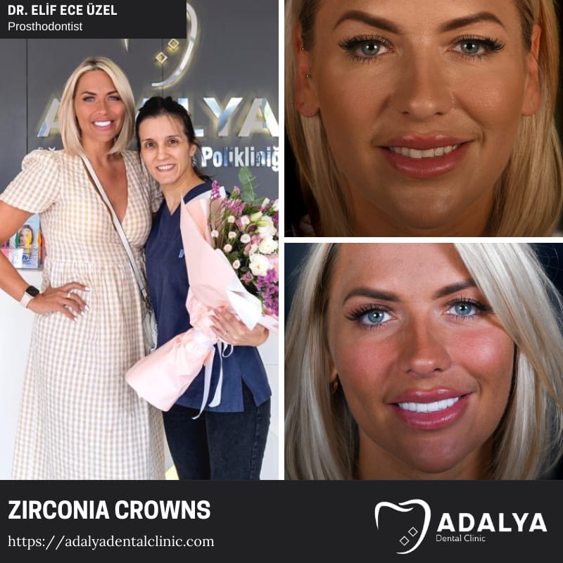 zirconia zirconium dental crowns veneers turkey antalya alanya istanbul marmaris cost price