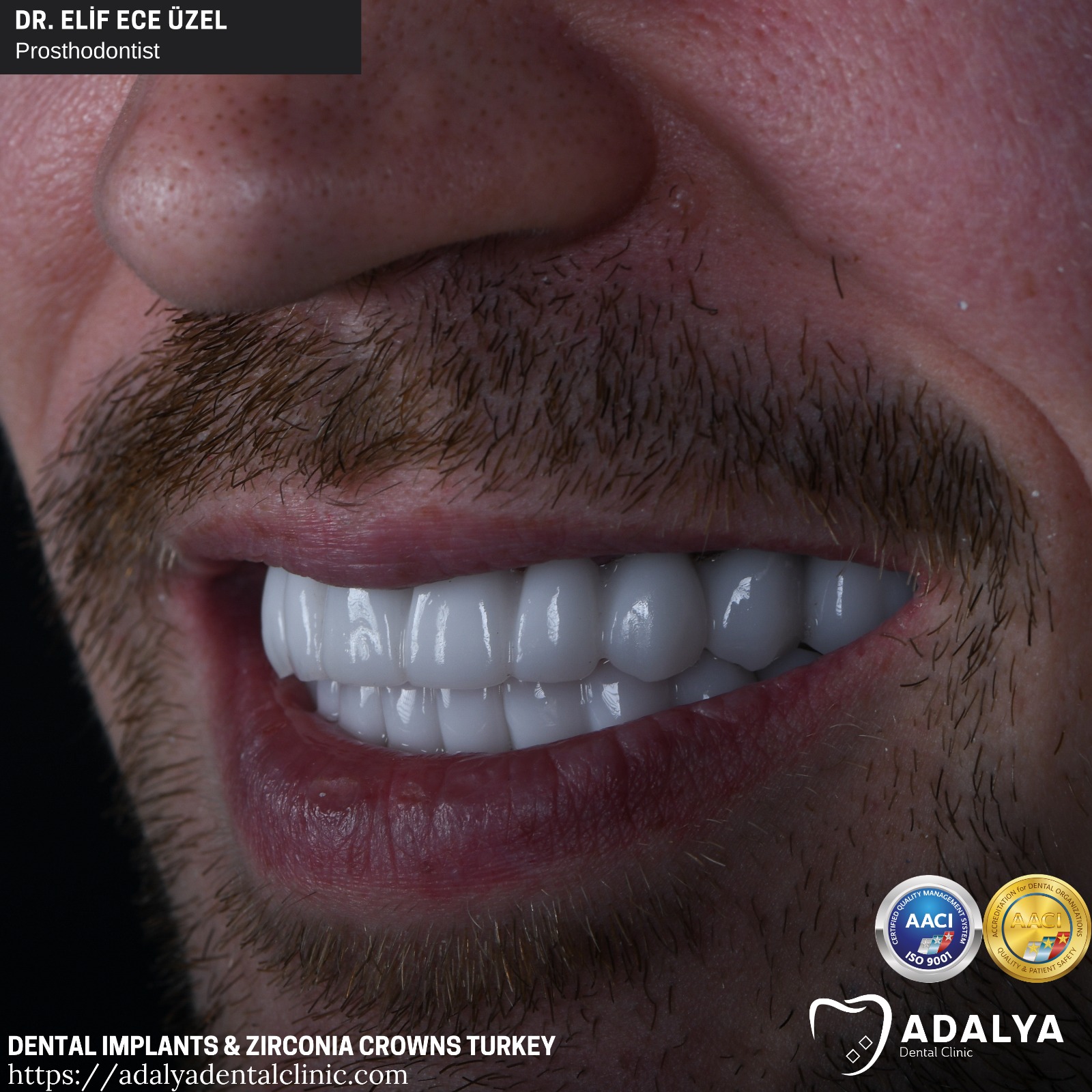 dental clinic turkey teeth tooth antalya prices dentist cost packages