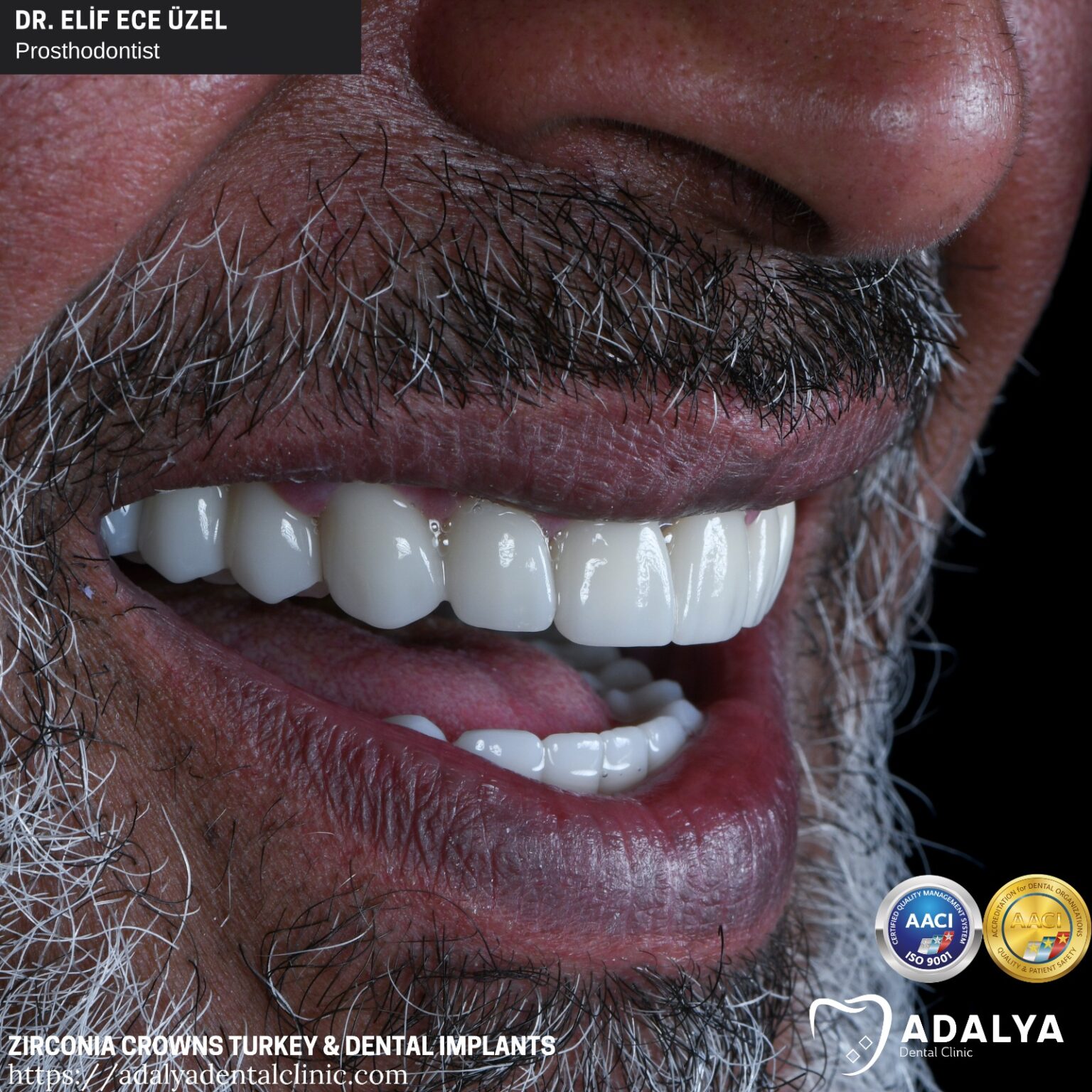 Dentistry Turkey Cosmetic Dentistry Antalya Adalya Dental Clinic