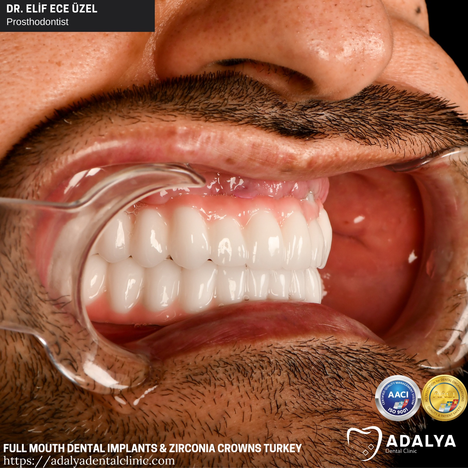 Zahnarzt Türkei Zähne Zahnimplantate Zentrum Preise Antalya
