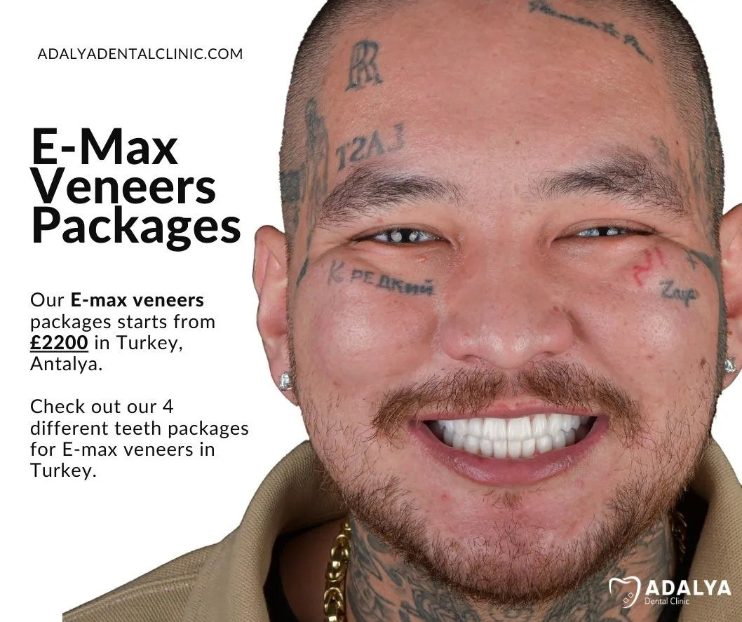 all-inclusive-turkey-dental-packages all inclusive turkey dental packages