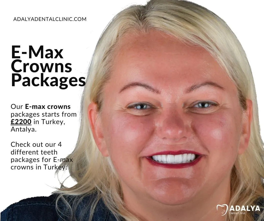 dental packages antalya