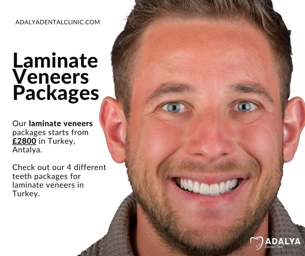 dental-packages-in-turkey-antalya-laminate dental packages in turkey antalya laminate