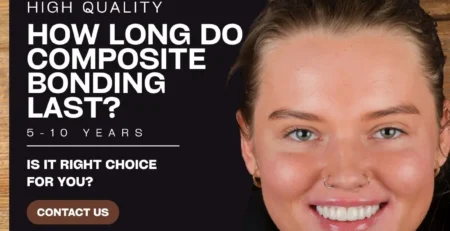 composite bonding how long does it last​