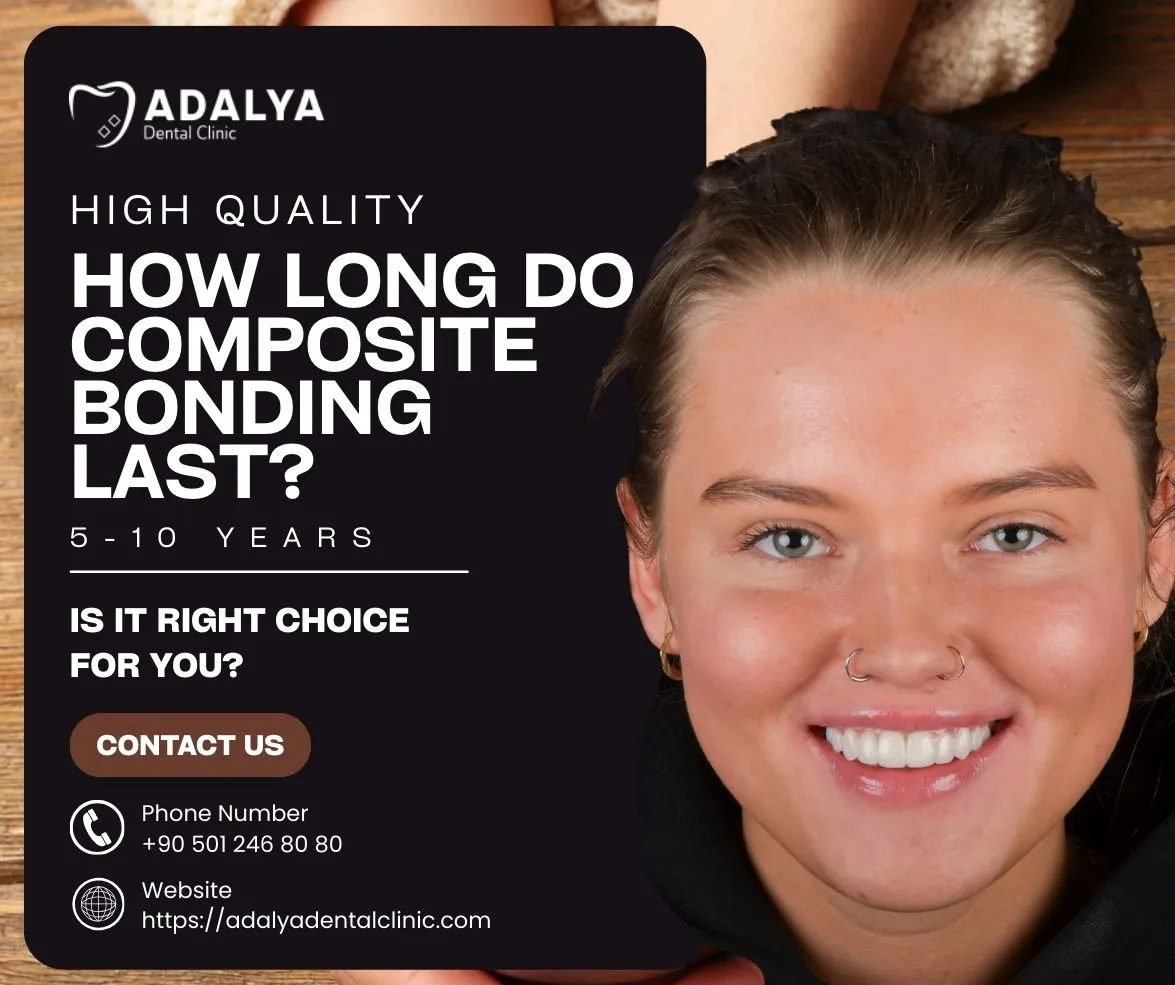 composite bonding how long does it last​