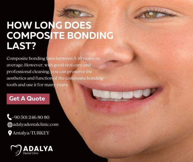 how long does composite bonding last