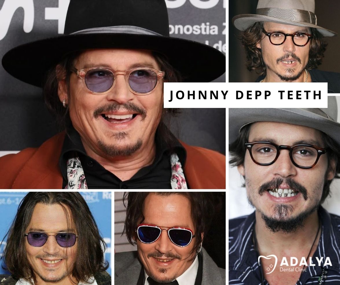 johnny depp teeth