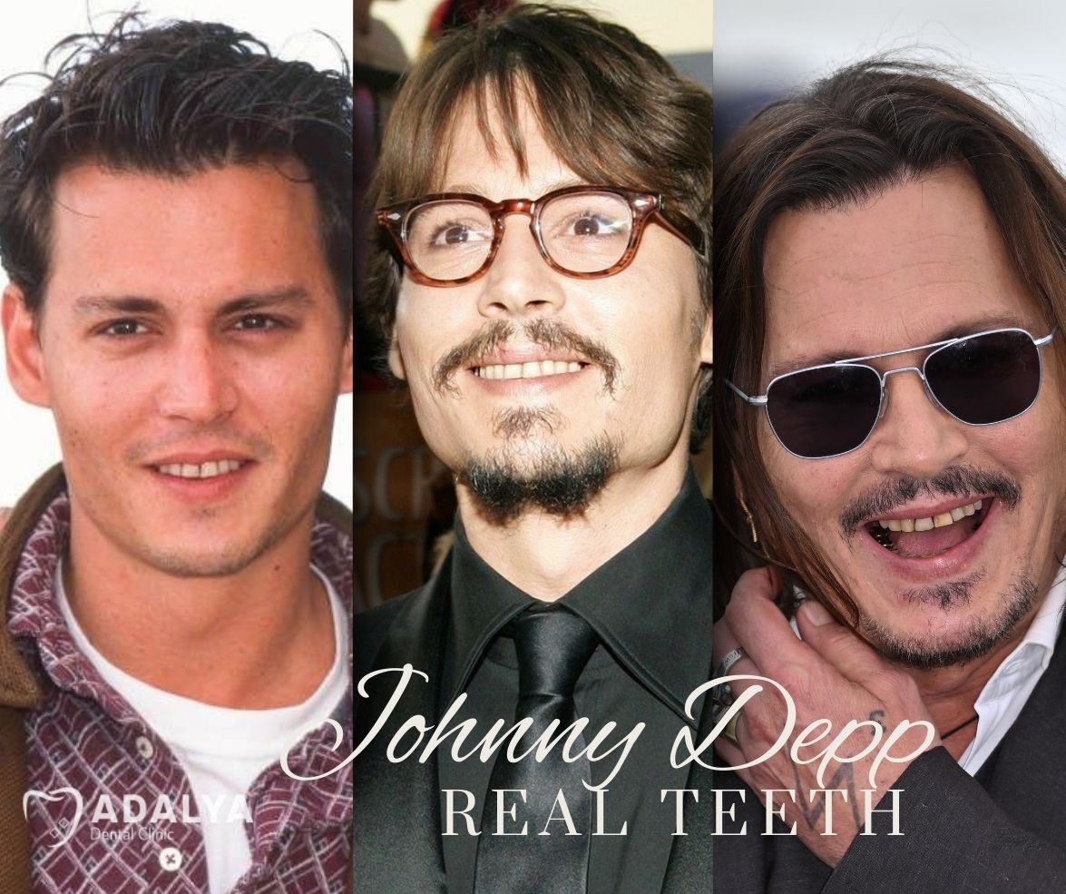 real teeth of depp