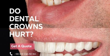 do dental crowns hurt