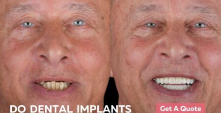 are dental implants painful