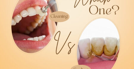 teeth scaling vs cleaning