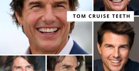 tom cruise teeth