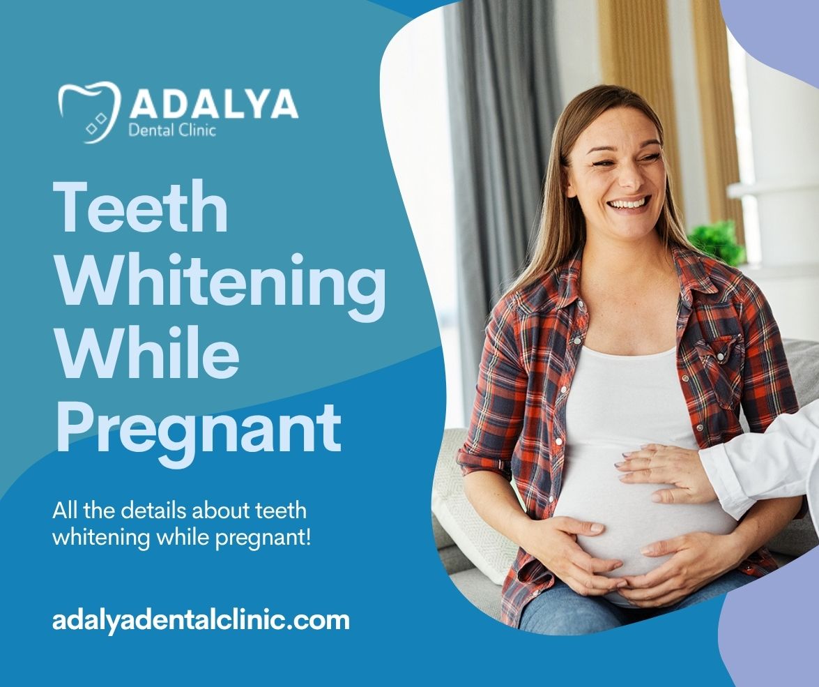 teeth whitening while pregnant