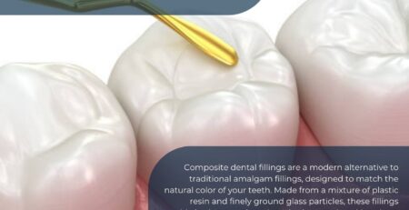 what is a composite dental filling