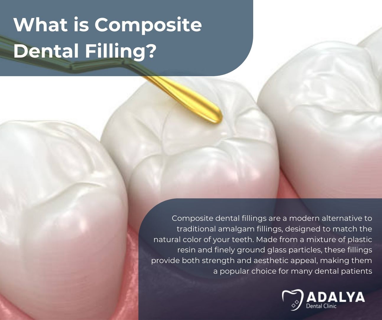 what is a composite dental filling