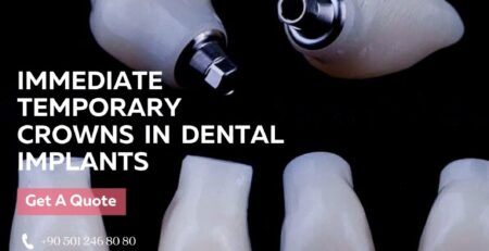 immediate temporary crowns loading in dental implants