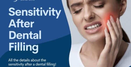 sensitivity after dental filling