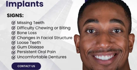 8 signs that you need dental implants