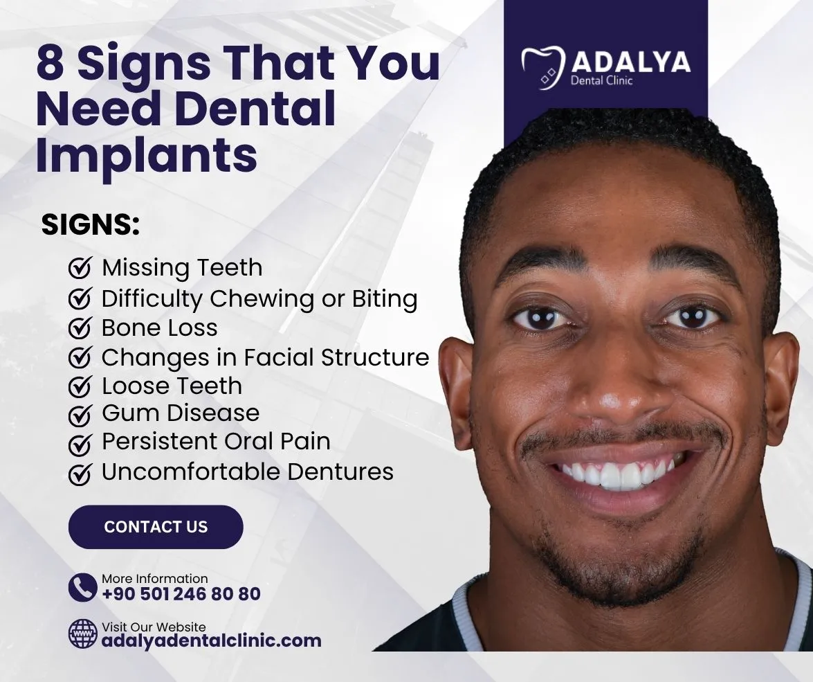 8 signs that you need dental implants