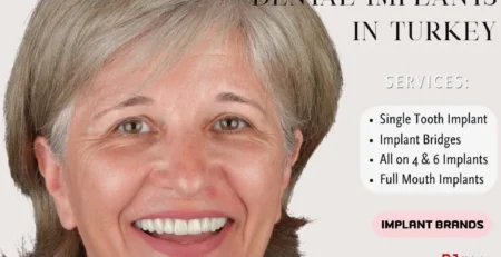 dental implants turkey