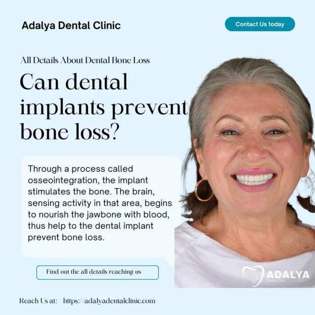 do dental implants prevent bone loss