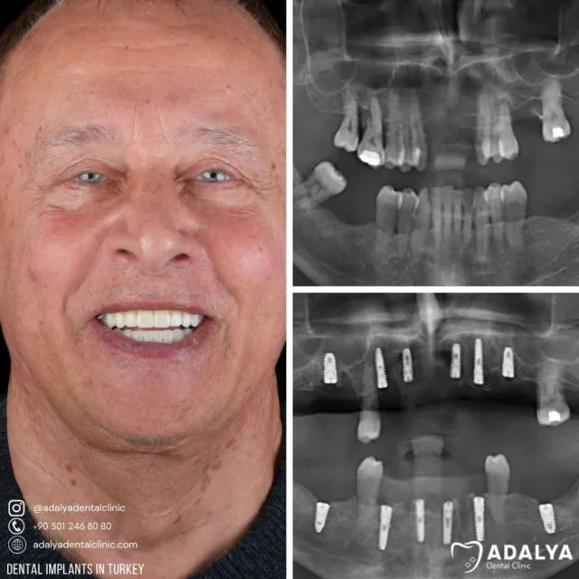 first visit of our patient