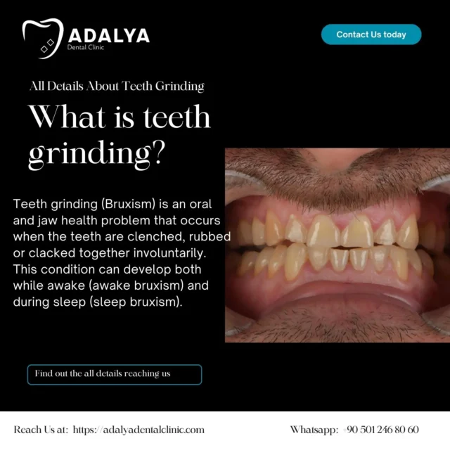 what is teeth grinding
