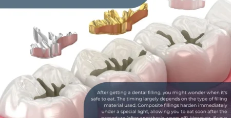 can you eat after a dental filling