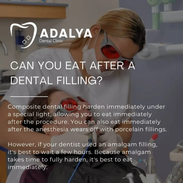 can-you-eat-after-having-a-dental-filling can you eat after having a dental filling