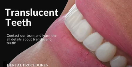 translucent teeth