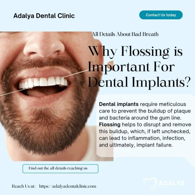 floss for dental implants