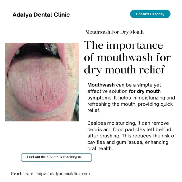 mouthwash for dry mouth