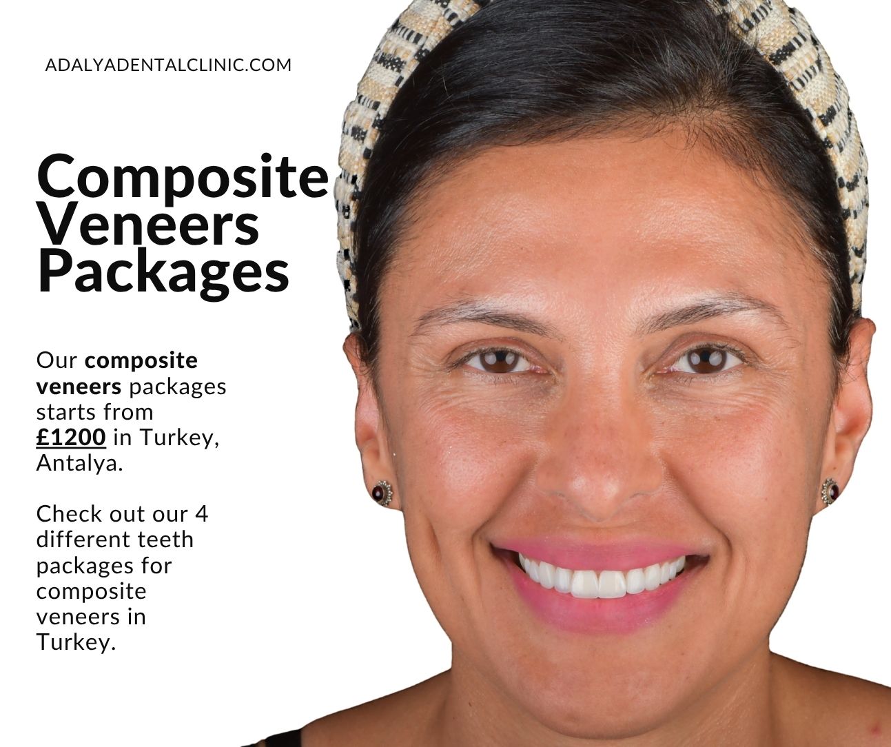 composite-veneers-package-deals-in-turkey-antalya composite veneers package deals in turkey antalya