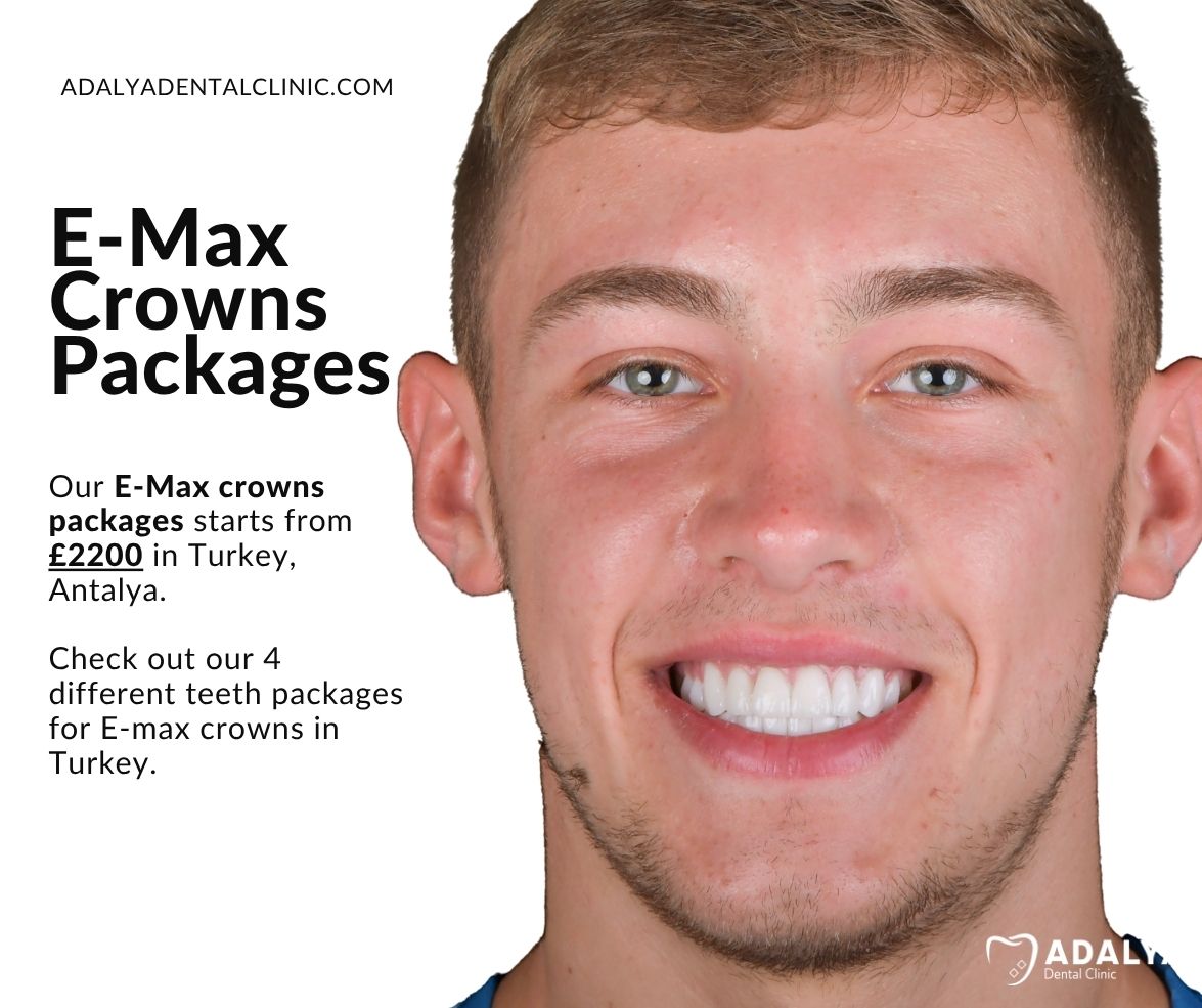 ips emax crown packages in turkey antalya