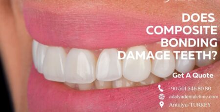 does composite bonding damage teeth