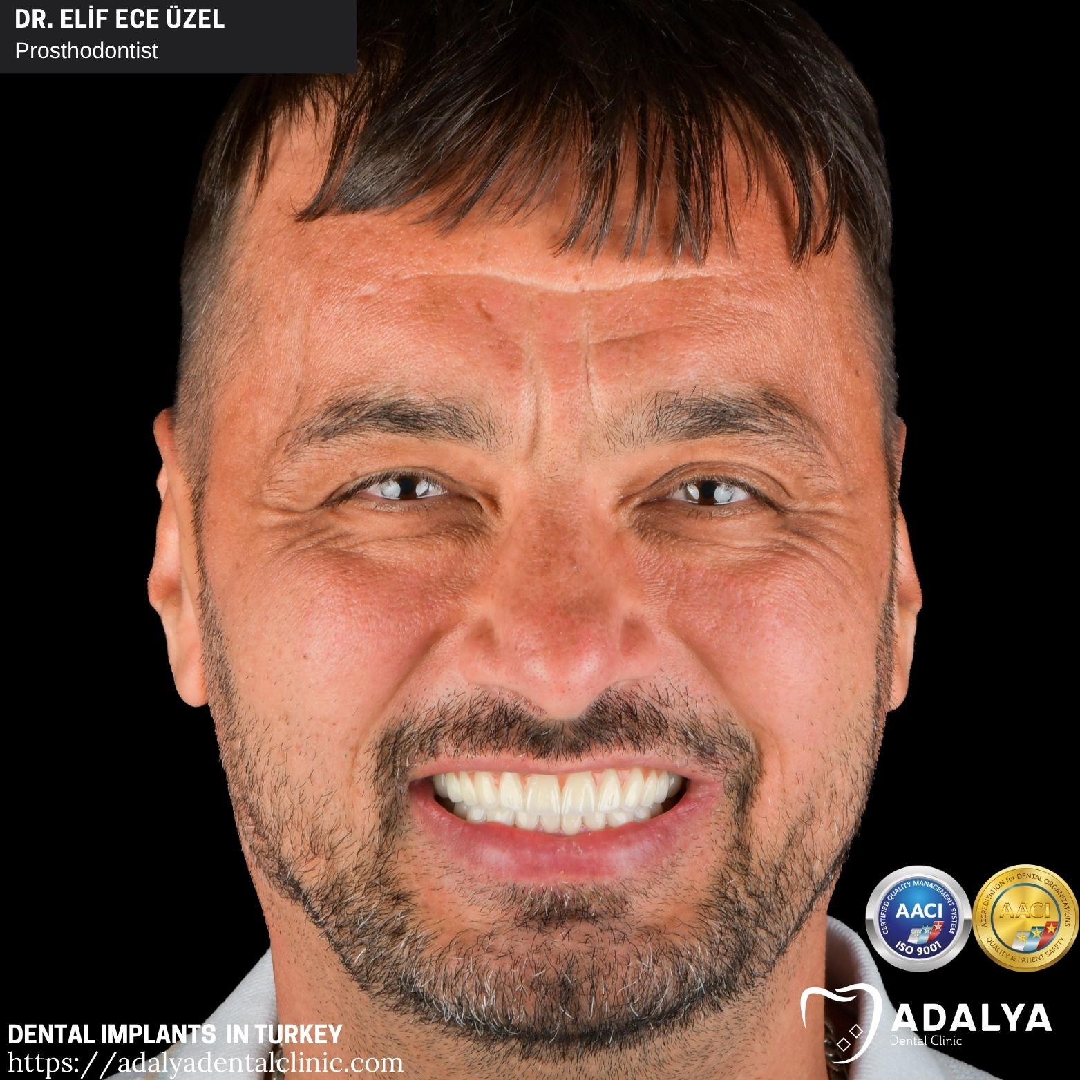 adalya teeth implant antalya turkey