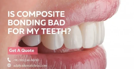 is composite bonding bad for my teeth
