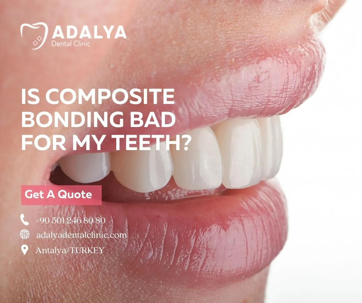 is composite bonding bad for my teeth