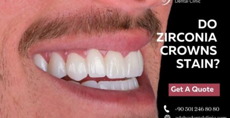 do zirconia crowns stain