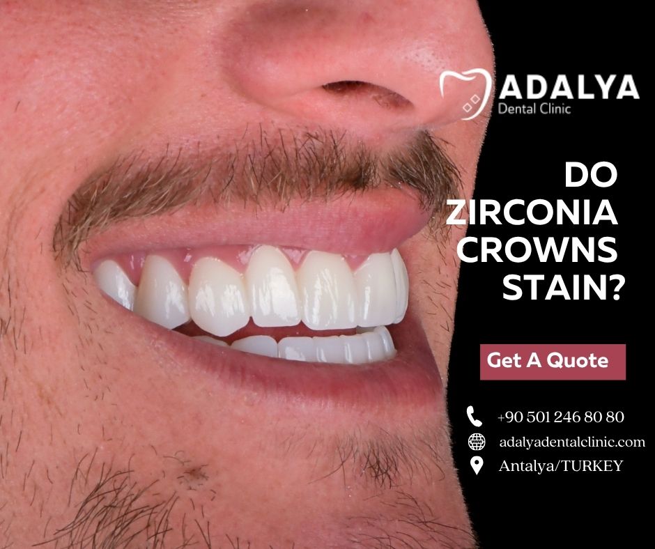 do zirconia crowns stain
