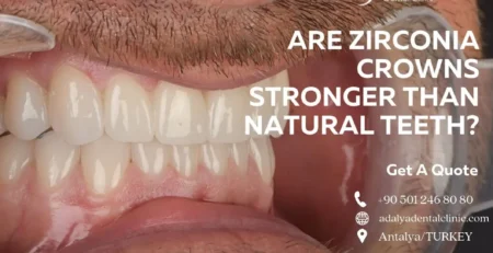 are zirconia crowns stronger than natural teeth