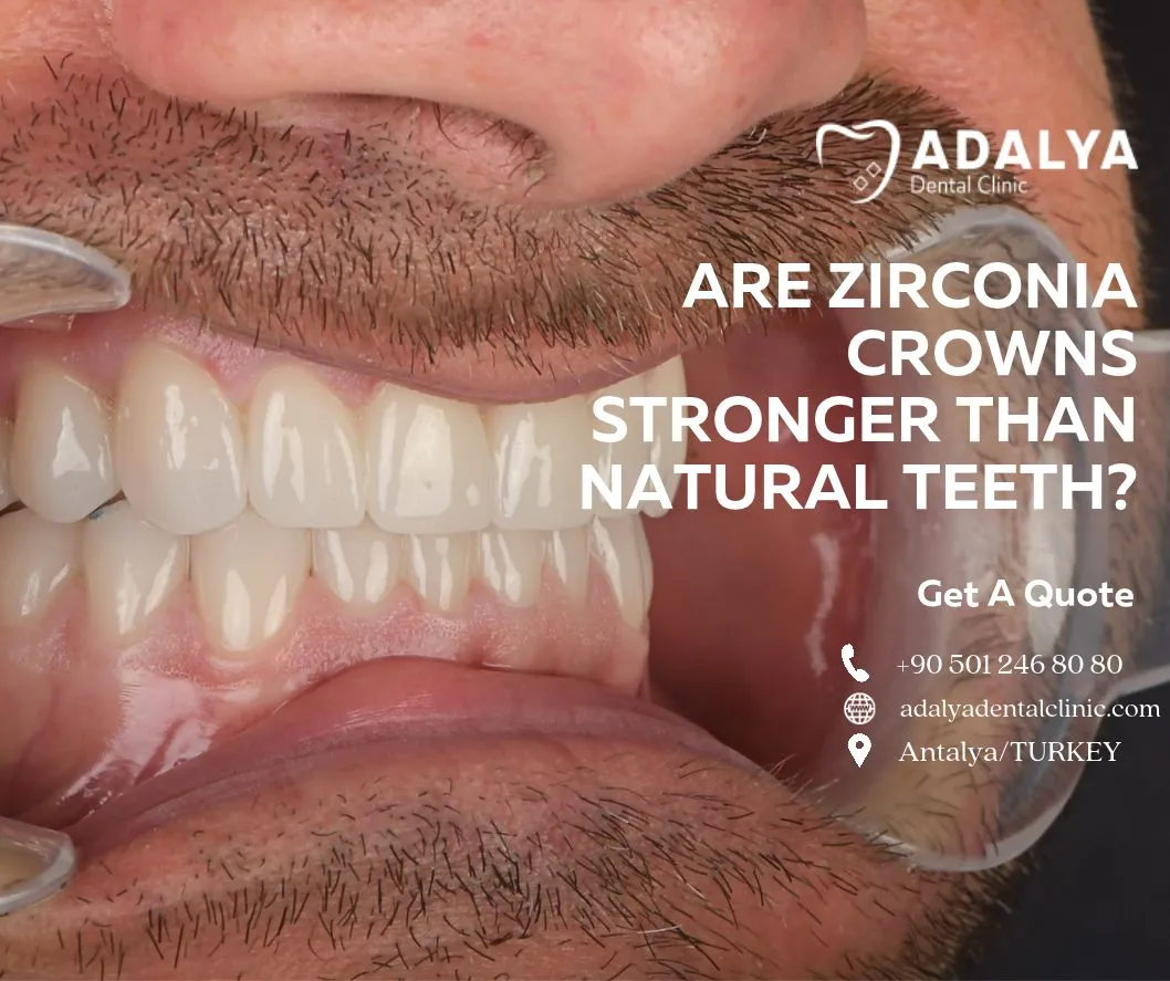 are zirconia crowns stronger than natural teeth